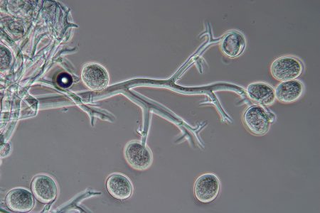 Patogénna huba peronospora.